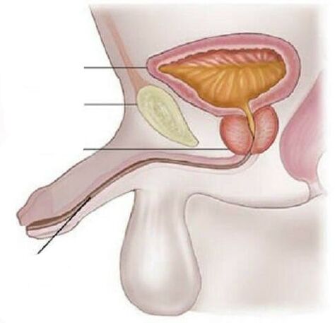 Cystitis in men