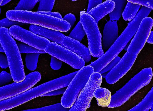 E. coli often causes the development of cystitis in women